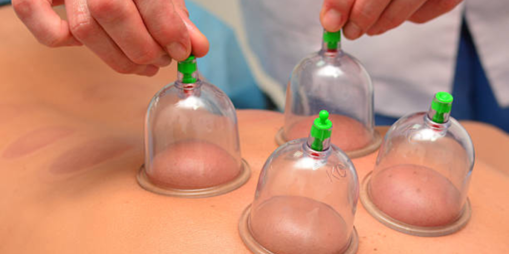 Hijama C 1